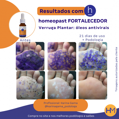 Fortalecedor de Unhas